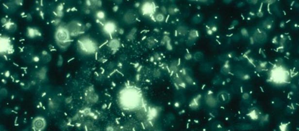 Darkfield-Microscopy